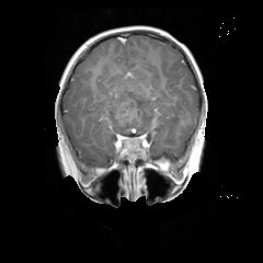 Sagittal t1ce slice